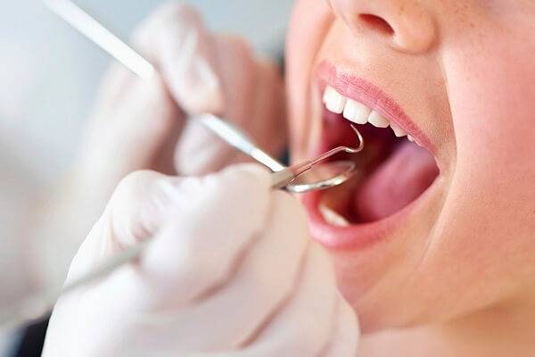Lấy cao răng ngăn ngừa các bệnh răng miệng