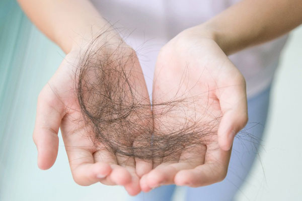 Bạn đã biết rụng tóc nhiều ở nữ là bệnh gì chưa?